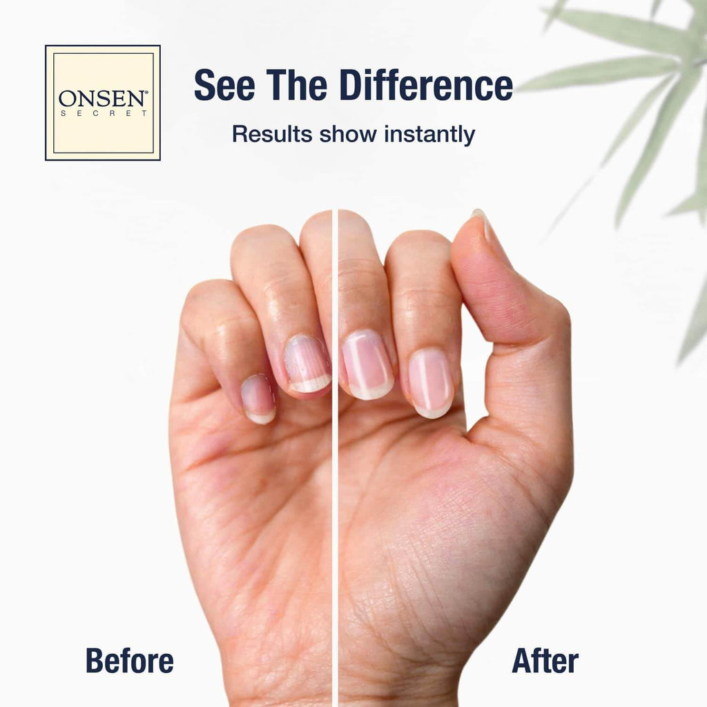 Nail Care Kit - W/Cuticle Care Serum, Japanese Nail Buffer and Shine Kit - Strengthening & Shining - Spa-Quality Manicure - Organic Ingredients - Long-Lasting Shine - Easy & Safe - 1Pk
