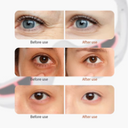 3D Eye Massager with Red Light and EMS – Reduces Dark Circles, Bags, and Eye Strain